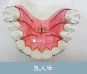 拡大床